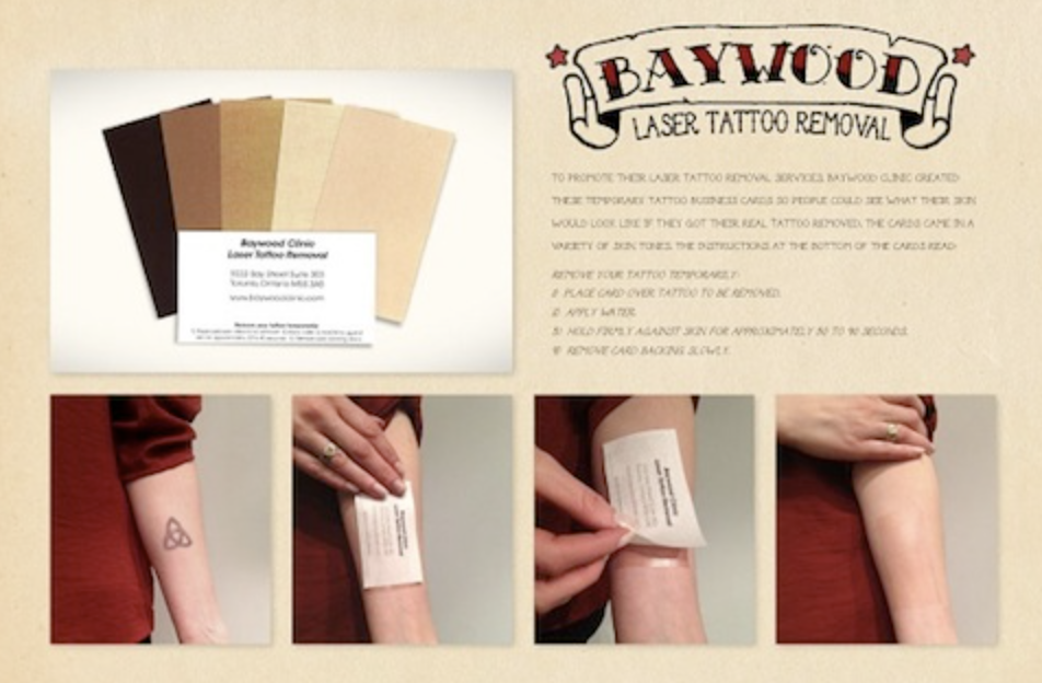 tattoo removal business cards